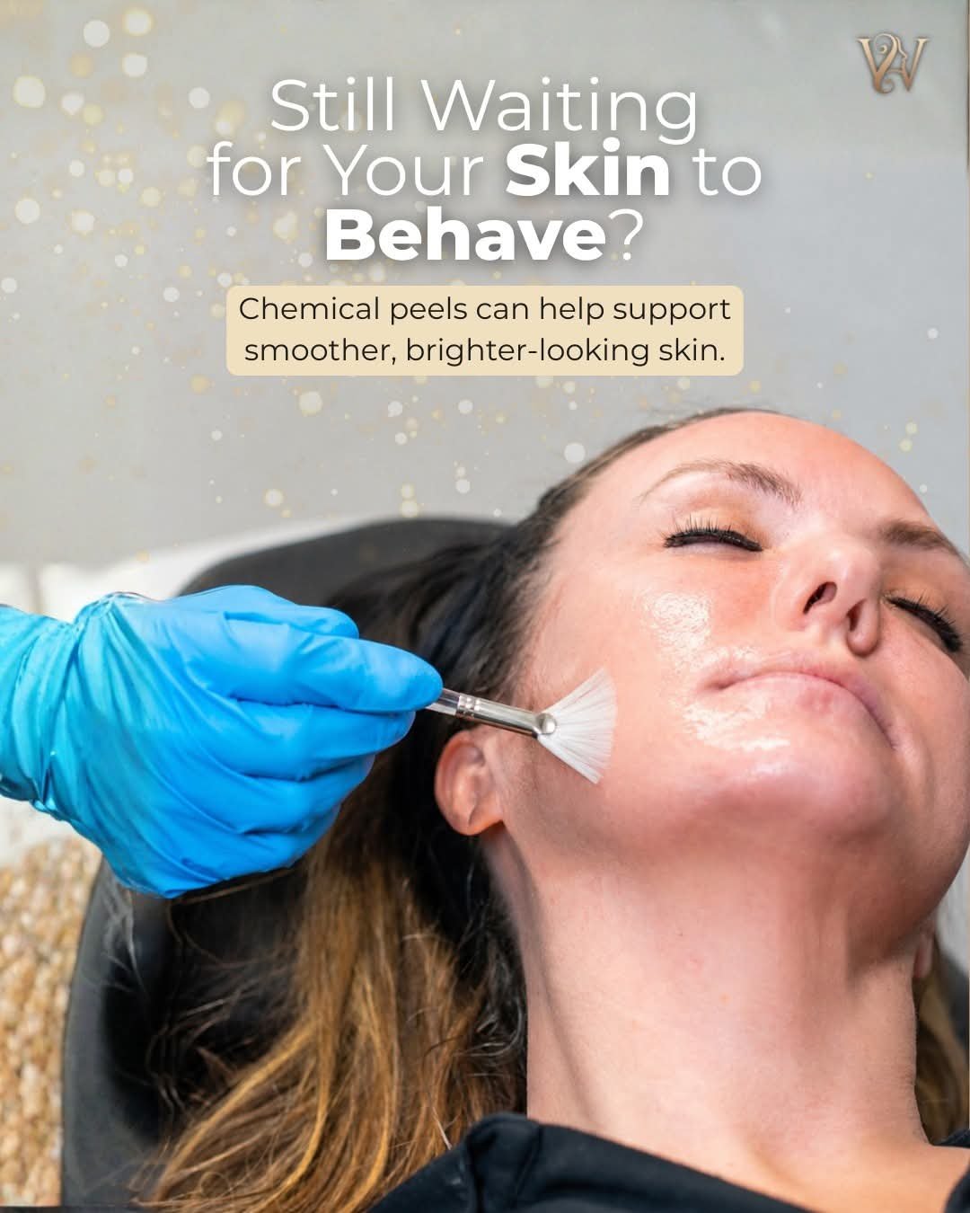 Real chemical peel treatment at the spa